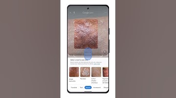 Identify Skin Conditions with Google Lens #Shorts