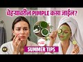 How to Control Oily Skin & Pimples in Summer | Majja Pinks Beauty Tips