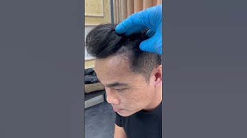 Thay đổi nhỏ, hiệu quả lớn #reviewxămtóc #vnscalp