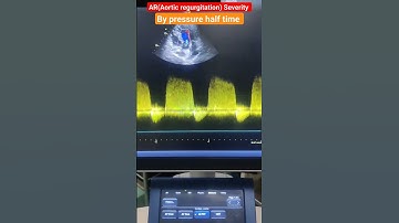 Aortic pressure half time measurement by echo l PHT lAR #shorts