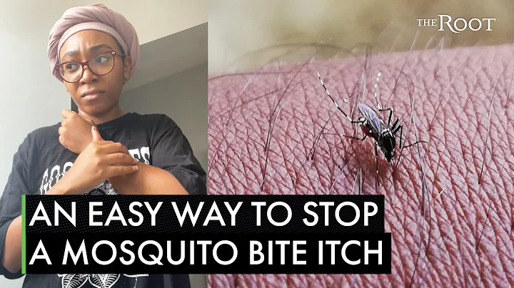 Mosquito Bite? Here's A Black Hack That'll Stop the Itch