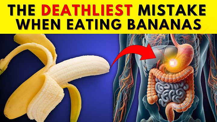 8 Serious Mistakes You’re Making When Eating Bananas – Stop Now!