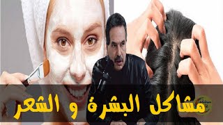 وصفات طبيعية لعلاج قشرة الشعر و النش و البقع الداكنة  - الدكتور جمال الصقلي -