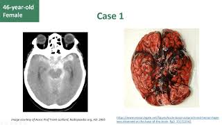 "A Crash Course in Neurological Emergencies" Presented by Dr Chris Jefferies