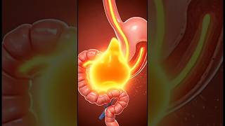 Painkiller Side Effects You Should Know😱 #shorts #drpurudhawan #kidneydialysis #kidneyhealth