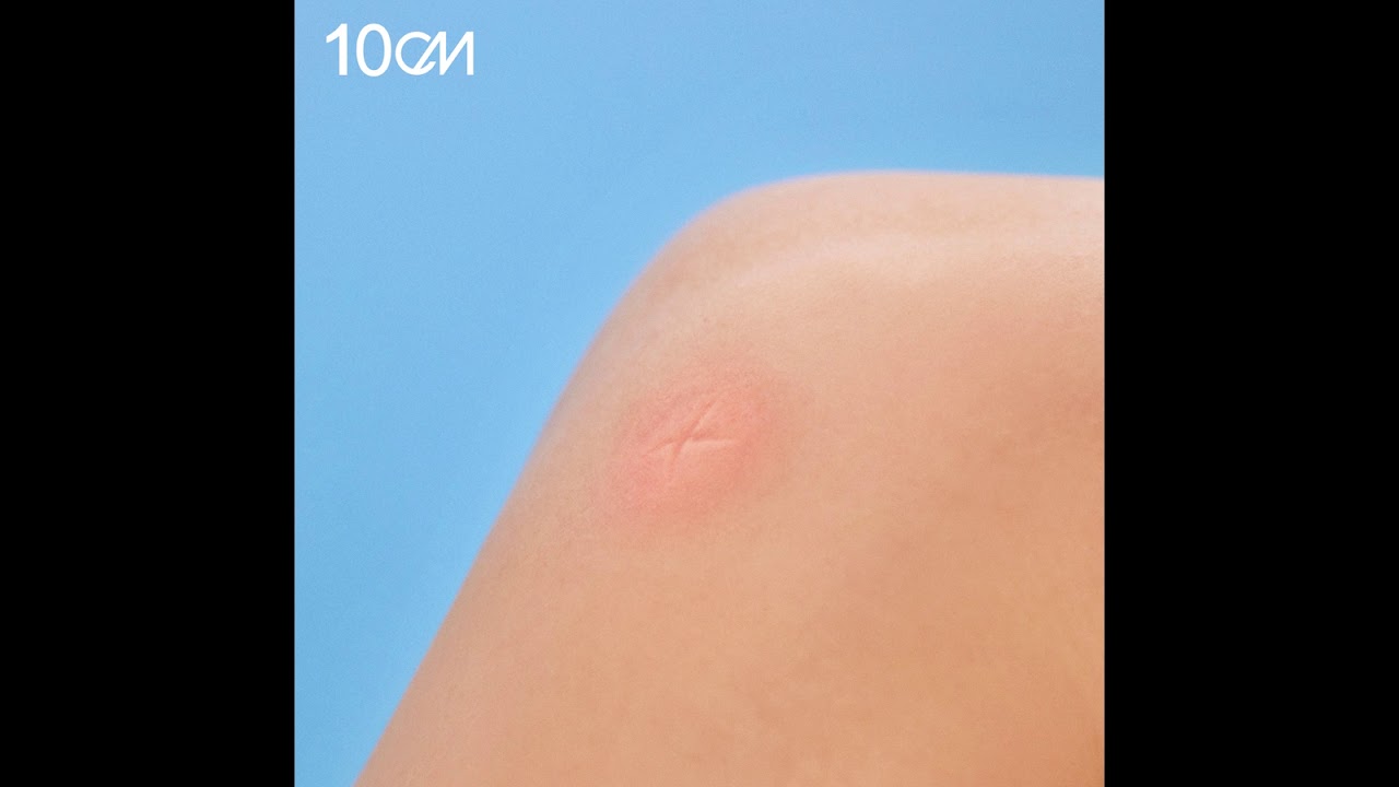 방에 모기가 있어 — 10cm