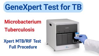 GeneXpert Test for TB | Full Procedure | Xpert MTB/RIF Test | Creative Zone Plus