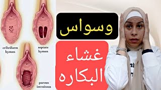 غشاء البكاره وكل ما يخص غشاء البكاره وسواس البكاره هحاوب علي كل أسئلتكم ف الفديو ده