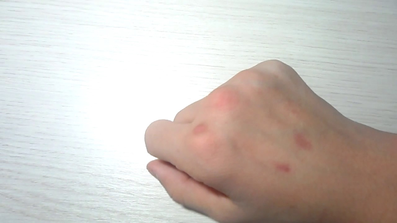 Что делать если разбил экран на телефоне - YouTube