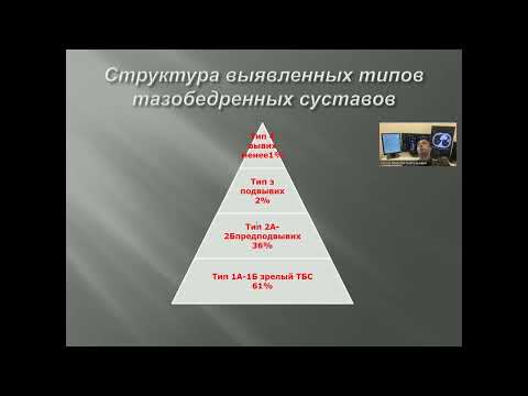 Видео: Являются ли дети с тазовым предлежанием более болезненными при ношении?