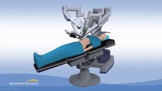 DMDaVinci Robotic Gallbladder Surgery