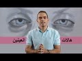 علاج الهالات والانتفاخات تحت العين - د. محمد الناظر