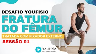 DESAFIO YOUFISIO PARA FRATURA DIAFISÁRIA DO FÊMUR TRATADA COM FIXADOR EXTERNO - SESSÃO 01