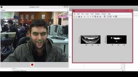 Teeth segmentation using Matlab
