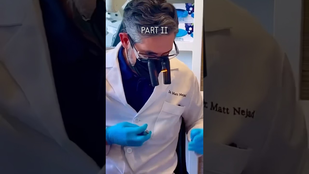 No-Prep Ceramic Veneer Repair: Part II 