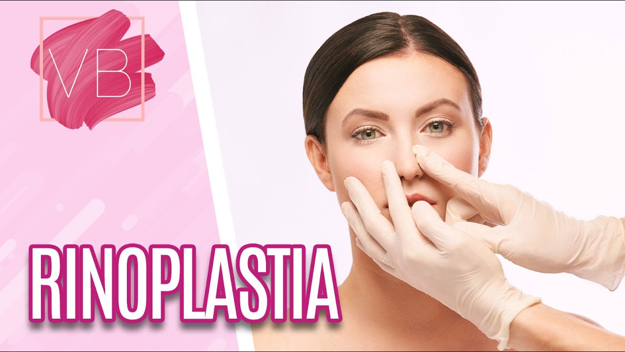 Rinoplastia: como é feita, riscos e pós-operatório - Você Bonita (11/08