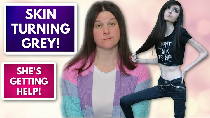 Eugenia Cooney's SKIN is Turning Gray! She ADMITS ...