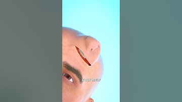 Growing A Nose On Your Forehead 😱