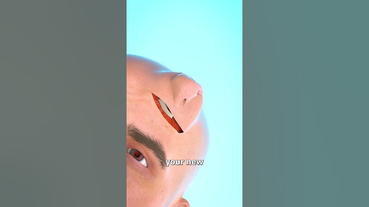 Growing A Nose On Your Forehead 😱