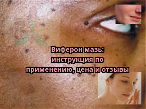 Виферон мазь: инструкция по применению, цена и отзывы Виферон мазь: инструкция по применению, цена и отзывы