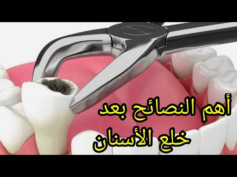 ما هي النصائح و التعليمات بعد خلع الأسنان