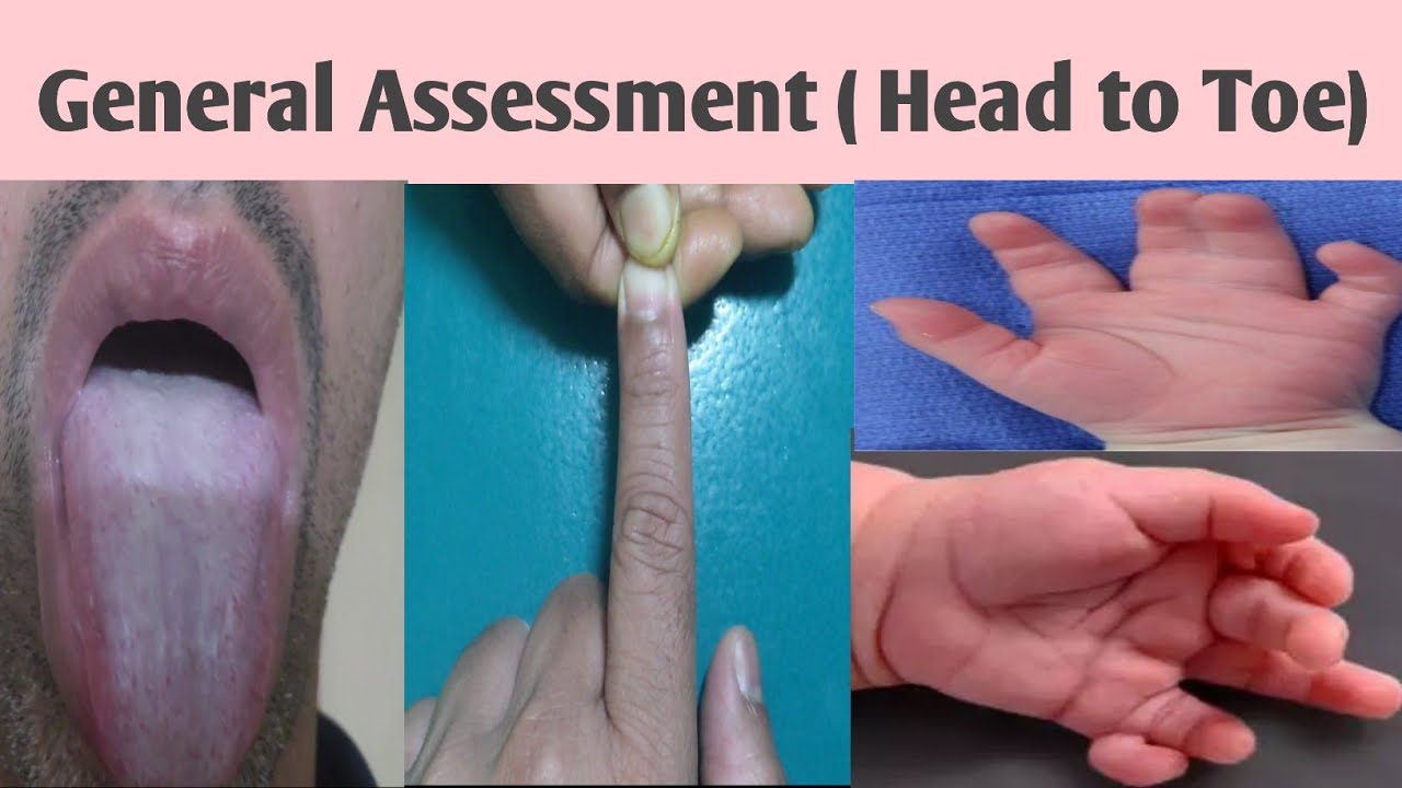NSG FON 23 General (Head to Toe) Assessment in Physical Examination