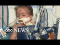 Scientists Reverse Brain Damage In A Toddler Scientists Reverse Brain Damage In A Toddler