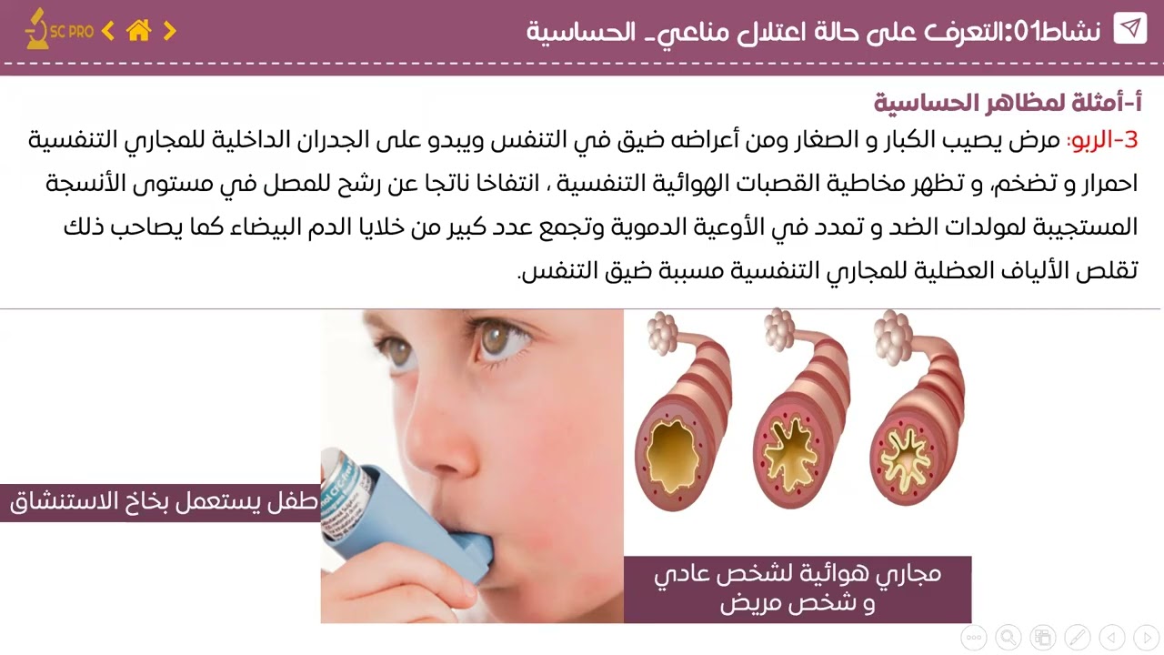 الحساسية رابعة متوسط