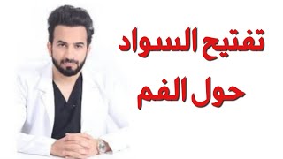 تفتيح السواد حول الفم - دكتور طلال المحيسن