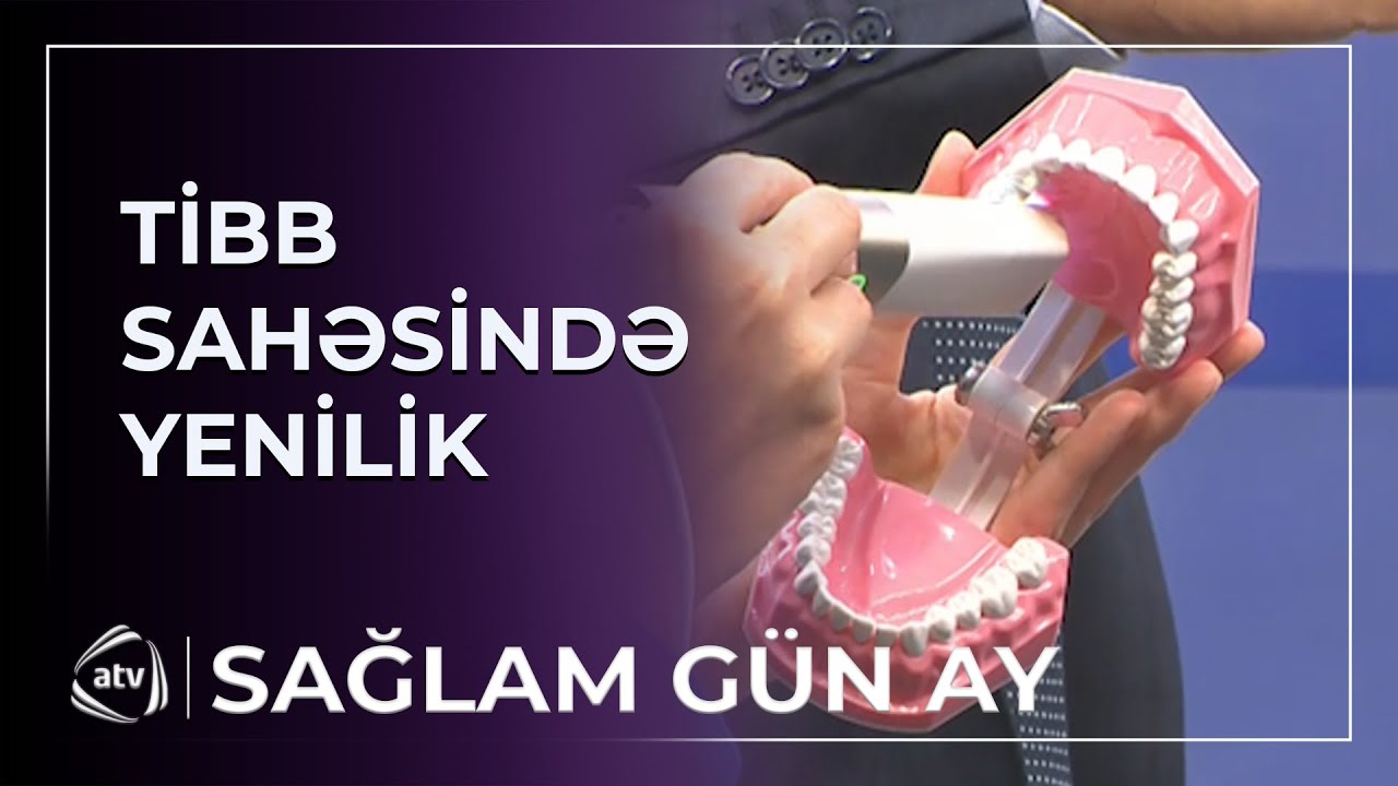 Günlərlə gözləməyə son! - 