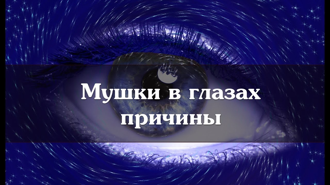 Мушки в глазах причины - YouTube