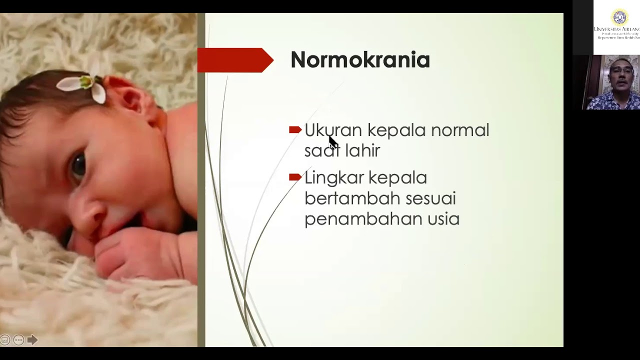 Neurosurgery Webinar Class Kelainan Bentuk  Kepala  dalam 