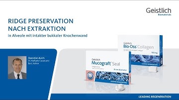 Ridge Preservation nach extraktion, in Alveole mit intakter bukkaler Knochenwand