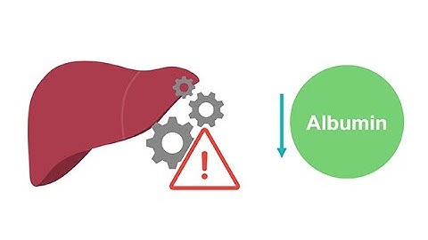 Getting to know albumin physiology