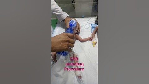 Newborn Baby CPR with Ambu Bag | NICU Emergency Care"
