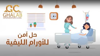 العلاج الآمن لعلاج الأورام الليفية - دكتور محمود غلاب