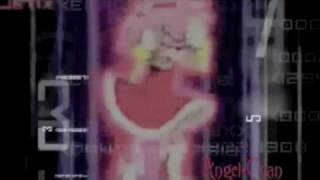 Face Down MEP Part 9
