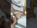 Baby IV Cannulation Made Easy – Watch This 😱💉b#shorts #viral #hospital #ivcannulation