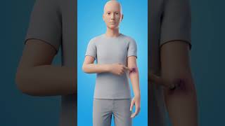 🩸 How Your Body Knows When To Stop Bleeding | आपका शरीर खून बहना कैसे रोकता है? #social #shorts