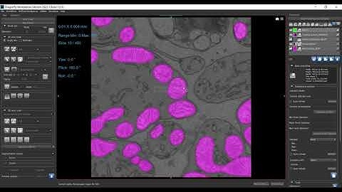 Mitochondria Segmentation Using Deep Learning | Dragonfly | U-Net Architecture | Microscopy Analysis