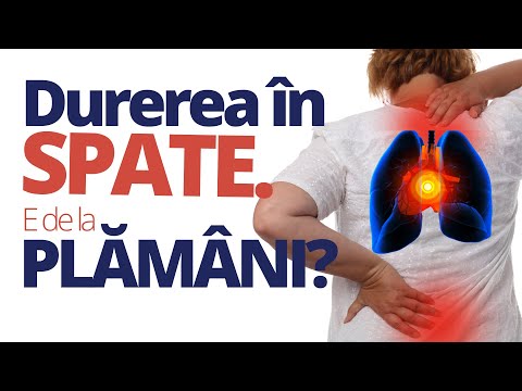 Video: Cutiile metalice din spate ar trebui legate la pământ?