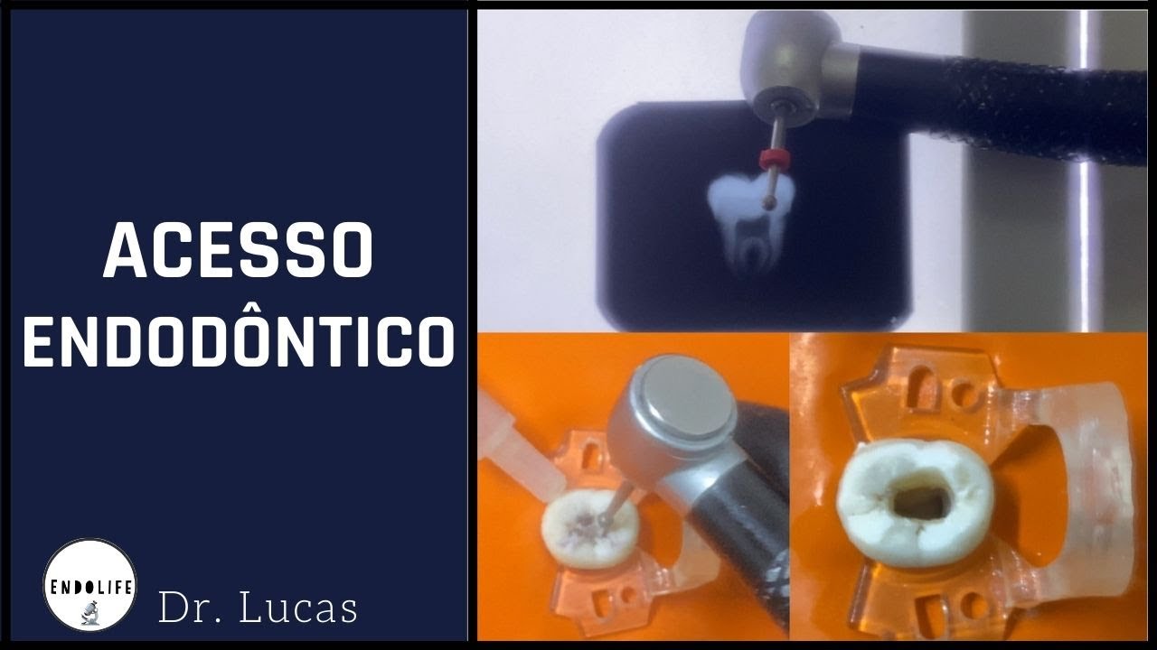 ACESSO ENDOD NTICO YouTube acesso-endod-ntico-youtube