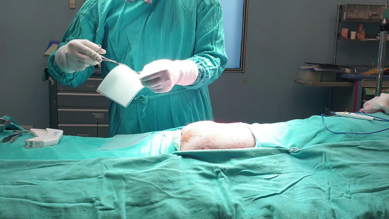 Integra application on a sacral pressure sore.Dr.Manish Nanda YouTube