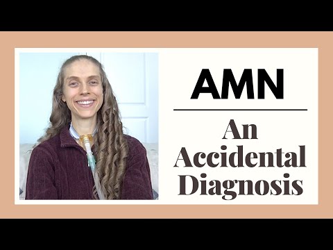 Adrenomyeloneuropathy: An Accidental Diagnosis. Hypoglycemia, Neuropathy & Adrenal Insufficiency