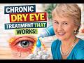 Chronic Dry Eyes New Treatments That Actually Work