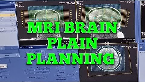 MRI BRAIN PLAIN PLANNING STEP BY STEP@MRI BRAIN PLANNING @MRI BRAIN GE MACHINE PLANNING