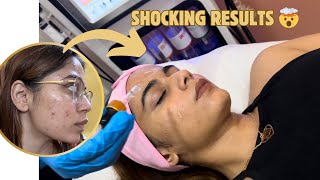 SHOCKING RESULTS 🤯 || Fit.with.riii