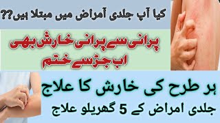 Kharish/ Jildi amraaz ka ilaj urdu/hindi | Skin problem and Solutions |#iching  خارش کا آسان علاج