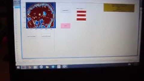 ECE 7400:Assignment 3 Image Registeration and 3D Slicer
