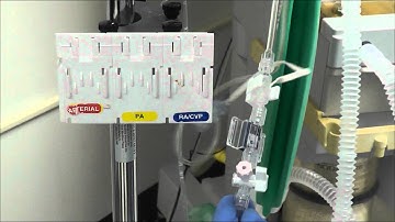 How to Setup an Arterial Line Transducer